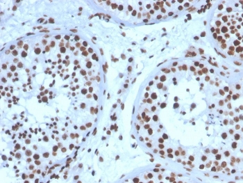 SF-1 Antibody Testis IHC. Immunohistochemistry analysis of FFPE human testis tissue stained with SF-1 Antibody demonstrates strong nuclear HRP-DAB brown staining within seminiferous tubule-associated cellular populations, consistent with expression of steroidogenic factor 1 / NR5A1 in reproductive and endocrine-associated transcriptionally active compartments. This steroidogenic transcription factor antibody highlights nuclear localization patterns associated with gonadal differentiation, steroidogenic signaling, and reproductive tissue-associated transcriptional regulation pathways. HIER: boil tissue sections in pH 9 10mM Tris with 1mM EDTA for 20 min and allow to cool before testing.