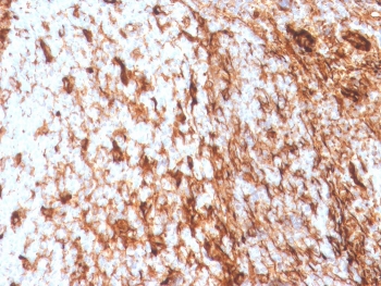Vimentin Antibody / Cell Migration Marker Antibody IHC. Immunohistochemistry analysis of FFPE human tonsil tissue using Vimentin antibody shows strong HRP-DAB brown cytoplasmic staining in stromal and mesenchymal cell populations, with minimal staining in lymphoid cells. The rabbit monoclonal clone VIM/4388R highlights elongated, interconnected cells within the stromal compartment, consistent with cytoskeletal organization in migratory cell types. The distribution of Vimentin-positive cells within the tissue supports its role as a marker of cell migration-associated mesenchymal populations.
