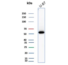 Vimentin Antibody / Cell Migration Marker Antibody WB. Western blot analysis of human U-87 MG cell lysate using Vimentin antibody detects a band at approximately 55 kDa, consistent with the predicted molecular weight of Vimentin (VIM). The rabbit monoclonal clone VIM/4388R shows a clear, single band, supporting detection of cytoskeletal components associated with migratory mesenchymal cells. The presence of Vimentin in U-87 MG cells aligns with its role in cytoskeletal organization linked to cell movement and invasive cellular behavior.