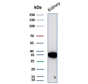 NAPSA Antibody for WB. Western blot analysis of Napsin A (NAPSA) expression in human kidney tissue lysate demonstrates a band at approximately 38-45 kDa, consistent with the predicted molecular weight of this glycosylated lysosomal aspartic protease. Clone NAPSA/4400R detects Napsin A with a defined band corresponding to processed protein species, reflecting proteolytic maturation associated with its role in epithelial protein processing.