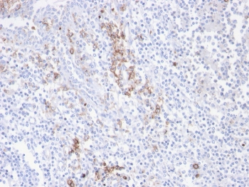 CD38 Antibody human tonsil tissue IHC. Immunohistochemistry analysis of CD38 / plasma cell marker expression in FFPE human tonsil using CD38 Antibody / Plasma Cell Marker Antibody. Strong membranous and cytoplasmic HRP-DAB brown staining highlights plasma cells within interfollicular regions, with scattered positive cells extending around germinal centers, consistent with antibody-secreting cell distribution. The staining pattern demonstrates clear identification of plasma cell populations with minimal background in surrounding lymphocytes. HIER was performed by boiling tissue sections in pH 9 10 mM Tris with 1 mM EDTA for 20 minutes followed by cooling prior to antibody incubation.