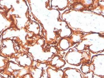 EGFR L858R Antibody Placenta IHC. Immunohistochemistry analysis of FFPE human placenta tissue stained with EGFR L858R mutation-specific antibody detecting mutant EGFR, clone GFR/4564R. Trophoblastic epithelial cells show membranous staining outlining cell borders. As normal placenta is not expected to harbor the L858R mutation, this signal should be interpreted cautiously and may reflect non-specific or low-level cross-reactivity. Hematoxylin counterstain highlights nuclei in blue. HIER: boil tissue sections in pH 9 10 mM Tris with 1 mM EDTA for 20 min and allow to cool before testing.