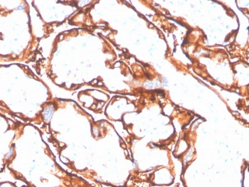 EGFR L858R Antibody Placental Trophoblast IHC. Immunohistochemistry analysis of FFPE human placenta tissue stained with EGFR L858R mutation-specific antibody detecting mutant EGFR, clone GFR/4564R. Trophoblastic epithelial cells show membranous staining outlining cell borders with focal cytoplasmic signal. As normal placenta is not expected to harbor the L858R mutation, this staining should be interpreted cautiously and may reflect non-specific or low-level cross-reactivity. Hematoxylin counterstain highlights nuclei in blue. HIER: boil tissue sections in pH 9 10 mM Tris with 1 mM EDTA for 20 min and allow to cool before testing.