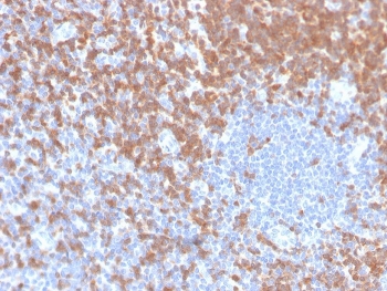 ZAP70 Antibody / Kinase Activation Regulation Antibody. Immunohistochemistry analysis of formalin-fixed, paraffin-embedded human tonsil tissue using ZAP70 Antibody / Kinase Activation Regulation Antibody. Antigen retrieval was performed by boiling sections in pH 9 Tris-EDTA buffer for 20 minutes followed by cooling. Cytoplasmic HRP-DAB brown staining is observed in lymphoid cell populations surrounding lighter germinal center regions, consistent with Zeta-chain-associated protein kinase 70 (ZAP70) expression and its tightly regulated, phosphorylation-dependent kinase activity. The staining pattern highlights compartmentalized lymphocyte populations within tonsillar architecture, supporting the role of ZAP70 in controlled activation and regulation of immune signaling within lymphoid tissue.