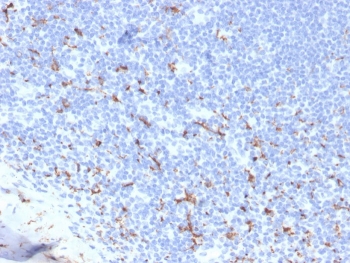 IHC staining of FFPE human tonsil with recombinant CD163 antibody (clone M130/3708R). HIER: boil tissue sections in pH 9 10mM Tris with 1mM EDTA for 20 min and allow to cool before testing.