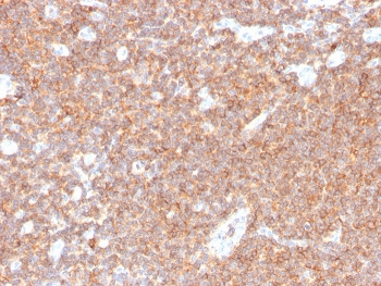 CD44 Antibody Tonsil Tissue IHC. Immunohistochemistry analysis of CD44 / CD44 antigen expression in FFPE human tonsil tissue using Cell Surface Receptor Signaling Antibody clone HCAM/4110R. Strong membranous HRP-DAB brown staining is present in lymphoid cell populations, outlining cell borders and reflecting localization of CD44 at the plasma membrane. The staining pattern demonstrates uniform signal across densely packed immune cells and supports its use for assessing receptor distribution and membrane-associated signaling interfaces in lymphoid tissue. Heat induced epitope retrieval was performed by boiling tissue sections in pH 9 10mM Tris with 1mM EDTA for 10-20 min followed by cooling at RT for 20 min.