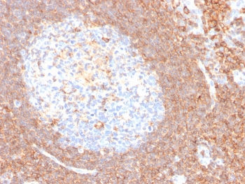 CD44 Antibody Tonsil Lymphoid Region IHC. Immunohistochemistry analysis of CD44 / CD44 antigen expression in FFPE human tonsil tissue using Cell Surface Receptor Signaling Antibody clone HCAM/4110R. Membrane-associated HRP-DAB brown staining is observed throughout lymphoid compartments, with prominent signal in surrounding cell populations and comparatively reduced staining in germinal center regions. This distribution highlights spatial variation in CD44 expression and supports its use for evaluating receptor localization and microenvironment-associated signaling patterns within tonsil tissue. Heat induced epitope retrieval was performed by boiling tissue sections in pH 9 10mM Tris with 1mM EDTA for 10-20 min followed by cooling at RT for 20 min.