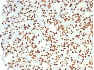 IHC staining of FFPE human kidney tissue with Nucleolin antibody (clone NCL/7014R). HIER: boil tissue sections in pH 9 10mM Tris with 1mM EDTA for 20 min and allow to cool before testing.