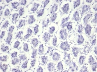 Negative: IHC staining of FFPE mouse stomach tissue with Nucleolin antibody (clone NCL/7014R). HIER: boil tissue sections in pH 9 10mM Tris with 1mM EDTA for 20 min and allow to cool before testing.