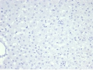 Negative: IHC staining of FFPE cat liver tissue with Nucleolin antibody (clone NCL/7014R). HIER: boil tissue sections in pH 9 10mM Tris with 1mM EDTA for 20 min and allow to cool before testing.