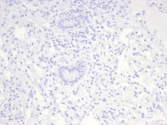 Negative: IHC staining of FFPE horse lung tissue with Nucleolin antibody (clone NCL/7014R). HIER: boil tissue sections in pH 9 10mM Tris with 1mM EDTA for 20 min and allow to cool before testing.