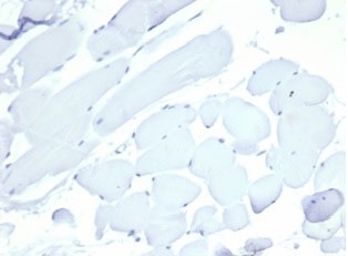 Negative: IHC staining of FFPE cow heart tissue with Nucleolin antibody (clone NCL/7014R). HIER: boil tissue sections in pH 9 10mM Tris with 1mM EDTA for 20 min and allow to cool before testing.