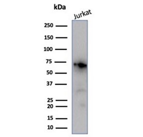 Western blot testing of human Jurkat cell lysate with Nucleolin antibody (clone NCL/7014R). Predicted molecular weight ~77 kDa, can be observed at 100~110 kDa.