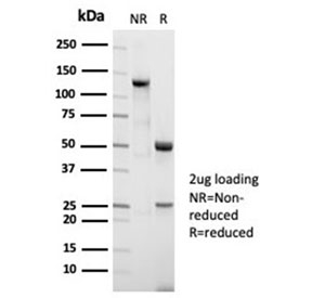 SDS-PAGE analysis of purified, BSA-free Nucleolin antibody (clone NCL/7014R) as confirmation of integrity and purity.
