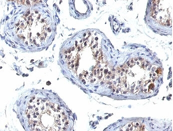 HGAL Antibody Human Testis Tissue IHC. Immunohistochemistry staining of FFPE human testis tissue with HGAL antibody (clone HGAL/830). HIER: boil tissue sections in pH 9 10mM Tris with 1mM EDTA for 20 min and allow to cool before testing.
