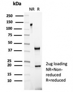 SDS-PAGE analysis of purified, BSA-free Negative control antibody (IGG1/453) as confirmation of integrity and purity.