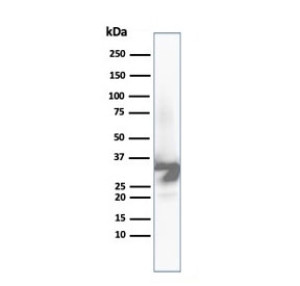 Western blot analysis of human liver tissue lysate using Arginase 1 Antibody ARG1/6790R. Predicted molecular weight ~35 kDa.