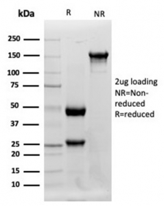 SDS-PAGE analysis of purified, BSA-free LYZ antibody (LYZ/3942) as confirmation of integrity and purity.