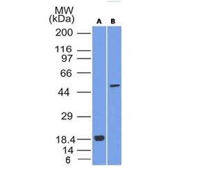 Western blot analysis of SOX10 (A) recombinant protein and (B) human A375 cell lysate using SOX10/Neural Crest Marker antibody (clone SOX10/992). Expected molecular weight: 50-58 kDa.