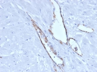 von Willebrand Factor Antibody / Weibel-Palade Body Marker Antibody. Immunohistochemistry analysis of human pancreatic tissue shows HRP-DAB brown staining of endothelial cells lining vascular channels, with signal localized to the cytoplasm in a granular pattern consistent with VWF-containing Weibel-Palade bodies. The staining outlines elongated vessel structures within the pancreatic stroma, while intracellular deposition highlights endothelial storage organelles along the vessel lining. Clone VWF/4106 enables visualization of both vascular architecture and subcellular VWF localization within endothelial compartments. HIER: boil tissue sections in pH 9 10mM Tris with 1mM EDTA for 20 min and allow to cool before testing.