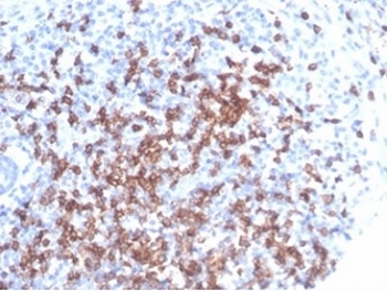 CD8A Antibody IHC Staining of Tonsil Tissue. Immunohistochemistry analysis of CD8 alpha (CD8A) in FFPE human tonsil tissue shows membranous staining of cytotoxic T lymphocytes within lymphoid regions, consistent with CD8-positive T cell subset identification in secondary lymphoid tissue. This antibody was generated using a cytoplasmic domain-derived immunogen. Heat-induced epitope retrieval was performed in pH 9 10 mM Tris with 1 mM EDTA for 20 minutes followed by cooling prior to antibody incubation.