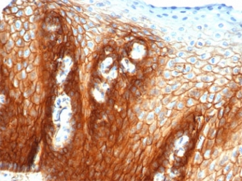 CD44 Antibody Esophagus Tissue IHC. Immunohistochemistry analysis of CD44 / CD44 antigen expression in FFPE human esophagus tissue using Epithelial Cell Adhesion Marker Antibody clone rHCAM/6449. Strong membranous HRP-DAB brown staining is observed in stratified squamous epithelial cells, outlining cell borders and highlighting organized epithelial layering consistent with CD44-mediated cell adhesion. The staining pattern demonstrates cohesive epithelial architecture and supports its use for evaluating cell-cell interaction, membrane localization, and structural integrity in esophageal epithelium. Heat induced epitope retrieval was performed by boiling tissue sections in pH 9 10mM Tris with 1mM EDTA for 20 min followed by cooling before testing.