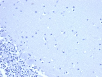 CD44 Antibody Brain IHC Negative Control: IHC staining of FFPE human brain tissue using CD44 antibody (clone rHCAM/6449) at 2ug/ml in PBS for 30min RT. HIER: boil tissue sections in pH 9 10mM Tris with 1mM EDTA for 20 min and allow to cool before testing.