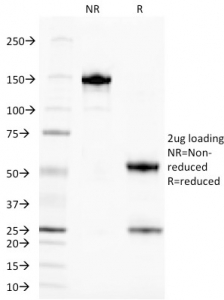 SDS-PAGE analysis of purified, BSA-free TAG-72 antibody (CA72/145) as confirmation of integrity and purity.
