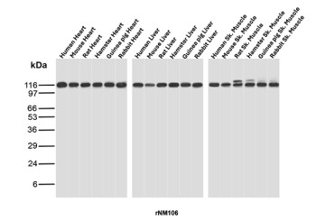 Recombinant Nuclear Antigen Antibody for WB Multi-Species Western Blot. Western blot analysis of heart, liver, and skeletal muscle tissue lysates from human, mouse, rat, hamster, guinea pig, and rabbit using Recombinant Nuclear Antigen Antibody for WB / Western Blot Validated Antibody (clone rNM106) demonstrates a strong immunoreactive band at approximately 110-116 kDa across all tested tissues and species. The highly consistent banding pattern indicates broad cross-species reactivity and recognition of a conserved nuclear-associated antigen expressed in diverse mammalian cell types. Robust signal is observed in cardiac, hepatic, and skeletal muscle samples from each species tested, supporting reliable detection of the target antigen in multiple biological systems. Because the recognized nuclear antigen is widely expressed and highly conserved, clone rNM106 serves as a valuable reagent for comparative biology studies, translational research, species cross-reactivity assessment, and western blot applications requiring broad mammalian reactivity. The observed molecular weight remains consistent across all tested samples and demonstrates the utility of this recombinant antibody for detection of nuclear-associated proteins in mammalian tissue lysates. Observed molecular weight: ~110-116 kDa.