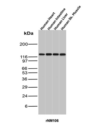Recombinant Nuclear Antigen Antibody for WB Human Tissue Western Blot. Western blot analysis of human heart, intestine, liver, and skeletal muscle tissue lysates using Recombinant Nuclear Antigen Antibody for WB / Western Blot Validated Antibody (clone rNM106) demonstrates a strong immunoreactive band at approximately 110-116 kDa in all tissues examined. The highly consistent banding pattern indicates robust recognition of a broadly expressed nuclear-associated antigen across multiple human tissue types. Comparable signal intensity is observed in cardiac, gastrointestinal, hepatic, and skeletal muscle samples, supporting widespread expression of the target antigen and reliable antibody performance in diverse biological specimens. Because the recognized nuclear antigen is conserved and broadly distributed among mammalian cell types, clone rNM106 serves as a valuable reagent for western blot studies involving tissue characterization, nuclear-associated protein detection, and comparative expression analysis. The observed molecular weight is consistent across all tested human tissues and demonstrates the utility of this recombinant antibody for detection of nuclear-associated antigens by western blot. Observed molecular weight: ~110-116 kDa.