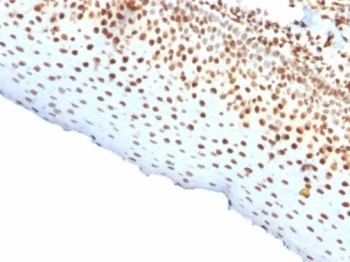 Recombinant Nuclear Antigen Antibody Human Tonsil Tissue IHC. Immunohistochemistry staining of FFPE human tonsil tissue using Pan-Nuclear Antigen Antibody (clone rNM106) demonstrates strong nuclear HRP-DAB brown staining throughout lymphoid cell populations. The staining pattern is consistent with recognition of a broadly expressed nuclear-associated antigen present within the nuclei of diverse cell types. Distinct nuclear localization provides clear visualization of cellular distribution, tissue architecture, and nuclear morphology while minimizing background staining in non-nuclear compartments. As a pan-nuclear marker, clone rNM106 is useful for identification of cell nuclei, assessment of tissue organization, and subcellular localization studies in both normal and pathological specimens. The observed staining highlights widespread nuclear labeling throughout the tonsillar lymphoid compartment and demonstrates the utility of this recombinant antibody for nuclear visualization applications.