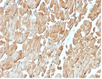 DMD Antibody Cardiac Muscle IHC. Immunohistochemistry analysis of FFPE human heart muscle tissue using DMD Antibody (clone DMD/3676) shows membranous staining outlining cardiomyocytes, consistent with detection of Dystrophin / DMD at the sarcolemma. The staining highlights cardiac muscle fiber architecture with moderate intensity, while interstitial regions display minimal background signal. Hematoxylin counterstain provides nuclear contrast and tissue morphology. HIER: boil FFPE tissue sections in pH 9 10 mM Tris with 1 mM EDTA for 20 min and allow to cool before testing.