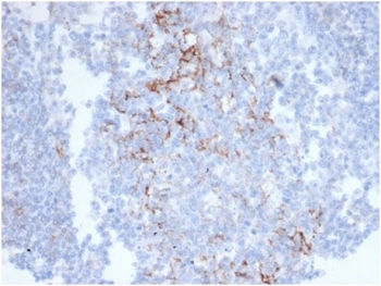 CD23 Antibody Colon Immunohistochemistry. IHC staining of FFPE human colon tissue with CD23 antibody (clone FCER2/6890) at 2ug/ml in PBS for 30min RT. HIER: boil tissue sections in pH 9 10mM Tris with 1mM EDTA for 20 min and allow to cool before testing.