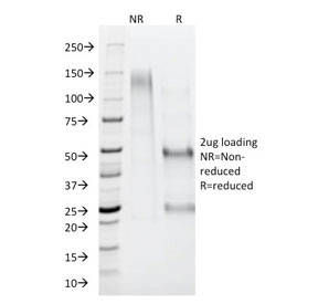 SDS-PAGE analysis of purified, BSA-free AMACR antibody as confirmation of integrity and purity.