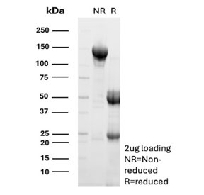 SDS-PAGE analysis of purified, BSA-free CD8B antibody (clone CBB/1595) as confirmation of integrity and purity.