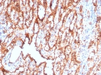 CD36 Antibody Spleen IHC. Immunohistochemical staining of FFPE human spleen demonstrates CD36 expression using CD36 antibody clone CD36/7217 at 2 ug/ml. CD36, also known as Fatty Acid Translocase, is a multifunctional scavenger receptor involved in long chain fatty acid uptake, lipid metabolism, and immune regulation. Prominent membranous and cytoplasmic staining is observed in splenic cells, consistent with the known expression of CD36 in macrophages and other immune cell populations. Heat induced epitope retrieval was performed by boiling tissue sections in pH 9 10 mM Tris buffer containing 1 mM EDTA for 20 minutes followed by cooling prior to staining. These results support the utility of CD36 Antibody for studies of lipid transport, inflammation, scavenger receptor biology, and immune responses.