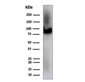 CD36 Antibody Heart WB. Western blot analysis of human heart tissue lysate demonstrates CD36 expression using CD36 antibody clone CD36/7217. CD36, also known as Fatty Acid Translocase, is a multifunctional scavenger receptor that mediates long chain fatty acid uptake and plays a critical role in cardiac energy metabolism. A prominent band is detected at approximately 90 kDa, consistent with the extensively glycosylated form of CD36. The apparent molecular weight of CD36 is known to vary from approximately 53 to 88 kDa depending on the degree of glycosylation. These results support the utility of CD36 Antibody for studies of lipid transport, cardiovascular biology, and metabolic regulation.