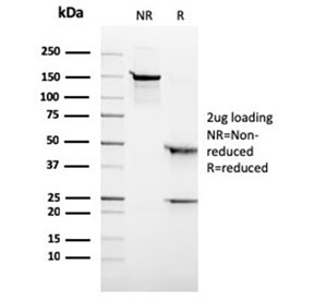 SDS-PAGE analysis of purified, BSA-free recombinant Anaplastic Lymphoma Kinase antibody (rALK1/1504) as confirmation of integrity and purity.