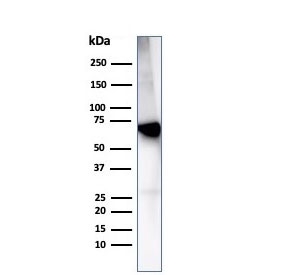 Western blot analysis of human liver tissue lysate using Albumin antibody (clone rALB/6414). Predicted molecular weight ~69 kDa.