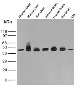 GLUL Antibody Multi-Tissue WB. Western blot analysis of human liver, mouse liver, rat liver, human brain, mouse brain, rat brain, and Y79 cell lysates using Glutamine synthetase Antibody mouse monoclonal clone GLUL/6600. A prominent band is detected at approximately 42-45 kDa across liver, brain, and Y79 samples, consistent with the predicted molecular weight of Glutamate-ammonia ligase / GLUL, an enzyme that catalyzes glutamine synthesis and plays a central role in nitrogen metabolism and neurotransmitter homeostasis. The broader and more intense signal observed in mouse liver lysate may reflect elevated GLUL expression and/or tissue-specific post-translational heterogeneity commonly observed in metabolically active hepatic tissue.