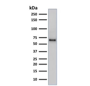SOX9 Antibody Human PC-3 Cancer Cell WB. Western blot analysis of human PC-3 prostate cancer cell lysate using SOX9 Antibody. Recombinant monoclonal antibody clone SOX9/2387 detects a distinct band at approximately 56-65 kDa, consistent with the predicted molecular weight of SOX9. SOX9 is a nuclear transcription factor associated with cancer stem cell regulation and differentiation, and expression in PC-3 cells aligns with its role in tumor progression. Minor variation in apparent molecular weight may reflect post-translational modifications or protein processing.