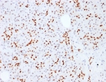 SOX9 Antibody Pancreas IHC. Immunohistochemistry analysis of FFPE human pancreatic tissue using SOX9 Antibody. The recombinant monoclonal antibody clone SOX9/2387 demonstrates strong nuclear HRP-DAB brown staining in ductal epithelial cells and scattered progenitor-like cell populations, consistent with SOX9âs role as a transcription factor and cancer stem cell-associated marker. Minimal staining is observed in surrounding stromal components. Heat-induced epitope retrieval was performed using pH 9 Tris-EDTA buffer, supporting robust nuclear signal detection in pancreatic tissue.