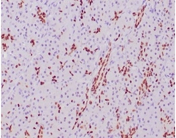 IHC staining of FFPE human pancreatic tissue with SOX9 antibody (clone SOX9/2387) at 2ug/ml. HIER: boil tissue sections in pH 9 10mM Tris with 1mM EDTA for 20 min and allow to cool before testing.
