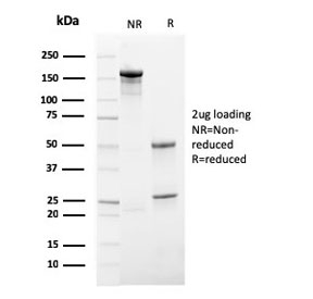 SDS-PAGE analysis of purified, BSA-free HSV1 antibody (clone HSV1/4055R) as confirmation of integrity and purity.