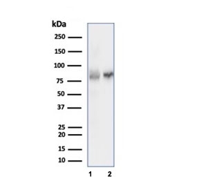 XRCC5 Antibody / Nuclear Localization and Redistribution Antibody for WB. Western blot analysis of XRCC5 (Ku80) in human cell lysates. Lane 1: MOLT-4 cell lysate, Lane 2: HEK293 cell lysate. A band is detected at approximately 80-86 kDa, consistent with the predicted molecular weight of XRCC5 (Ku80). The consistent detection across both lymphoid and epithelial-derived cells supports the widespread expression of XRCC5, providing a foundation for studying its nuclear localization and dynamic redistribution between cellular compartments.