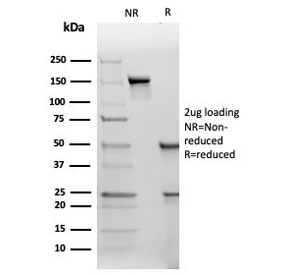 SDS-PAGE analysis of purified, BSA-free TIMP2 antibody (clone TIMP2/4477) as confirmation of integrity and purity.