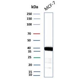 Western blot testing of human MCF7 cell lysate with recombinant EpCAM antibody. Expected molecular weight: ~35 kDa (unmodified), 40-43 kDa (glycosylated).