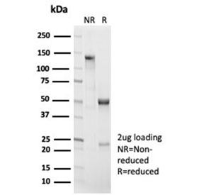 SDS-PAGE analysis of purified, BSA-free recombinant Beta Catenin antibody (clone CTNNB1/7044R) as confirmation of integrity and purity.