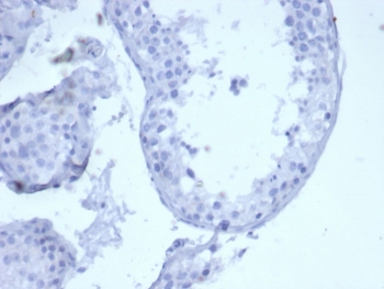 Negative control: IHC staining of FFPE human brain tissue using recombinant Keratin 5 antibody (clone KRT5/6399R) at 2ug/ml in PBS for 30min RT. HIER: boil tissue sections in pH 9 10mM Tris with 1mM EDTA for 20 min and allow to cool before testing.
