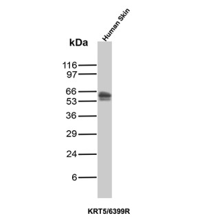 Western blot analysis of human skin tissue lysate using Keratin 5 Antibody KRT5/6399R.
